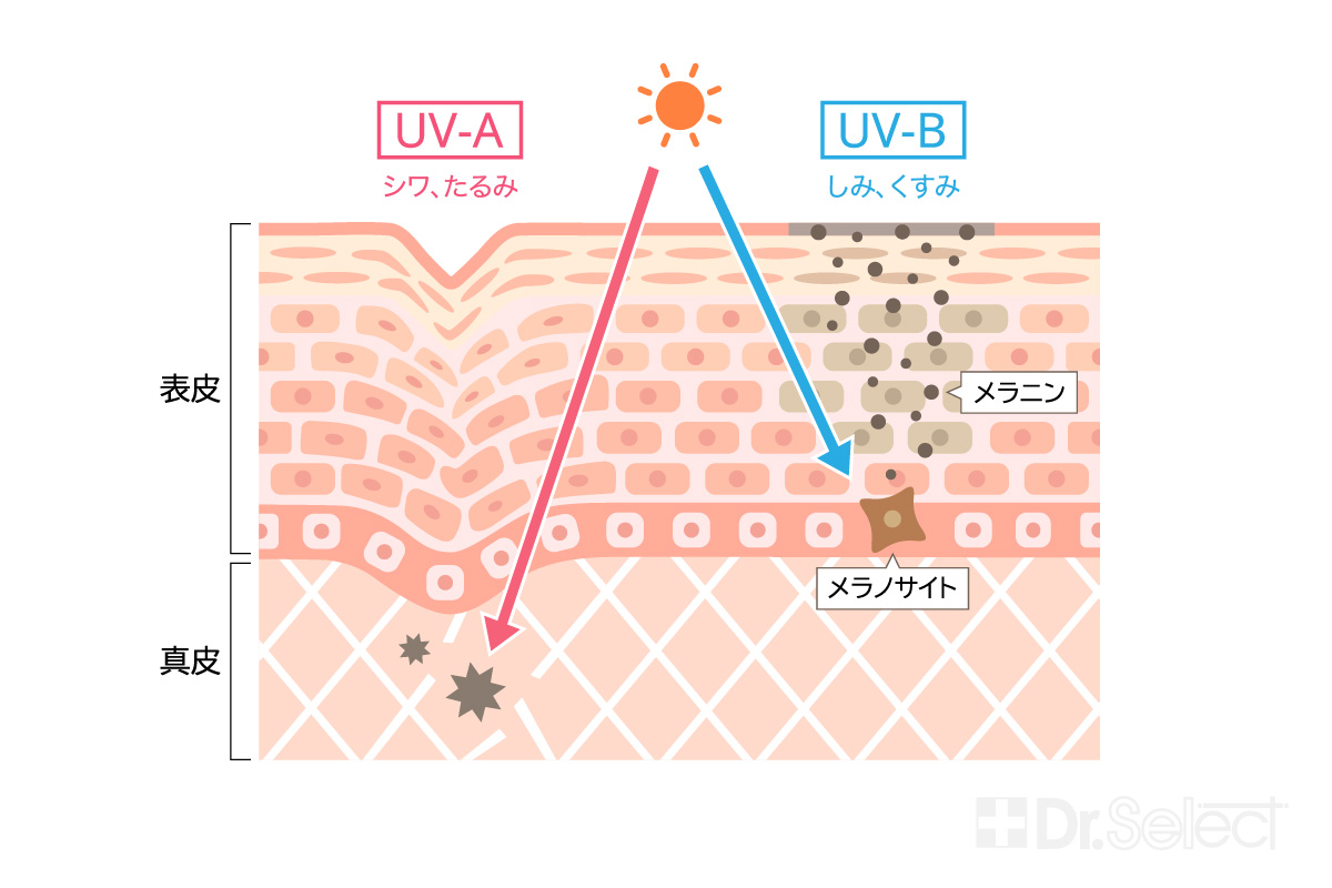 色素沈着の主な原因についての説明図