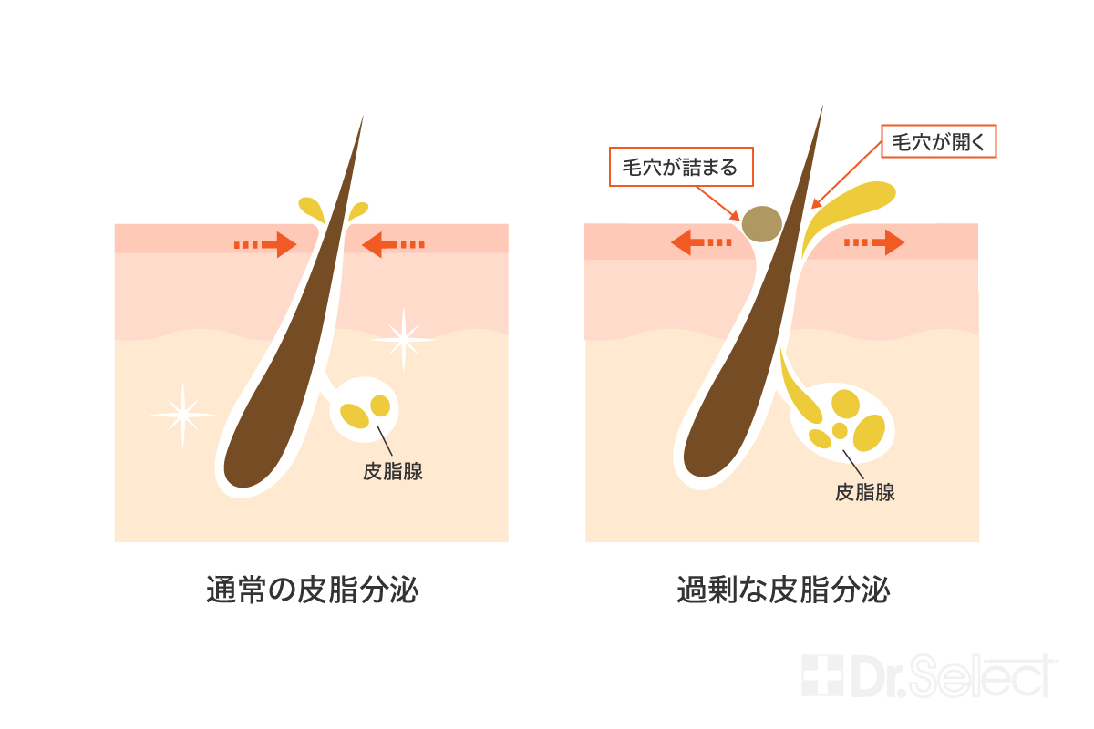 そもそも毛穴とは？