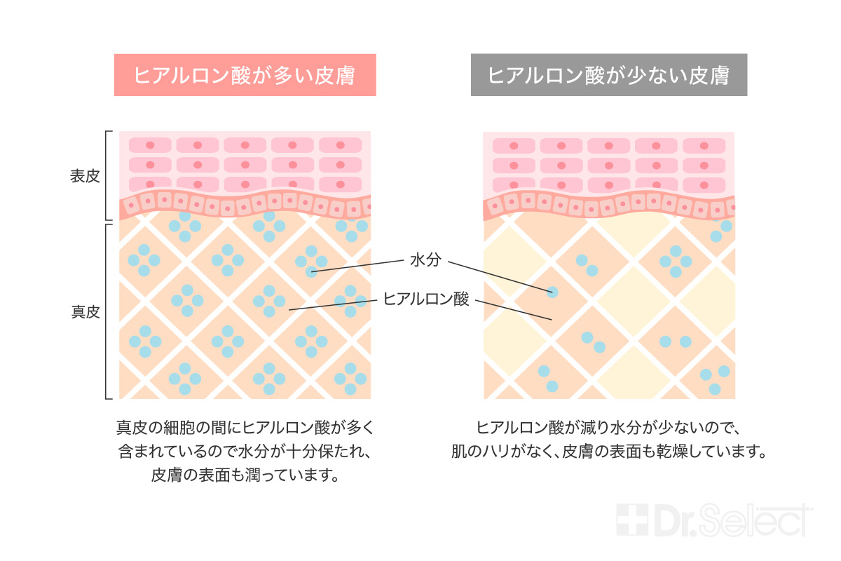 皮膚の構造