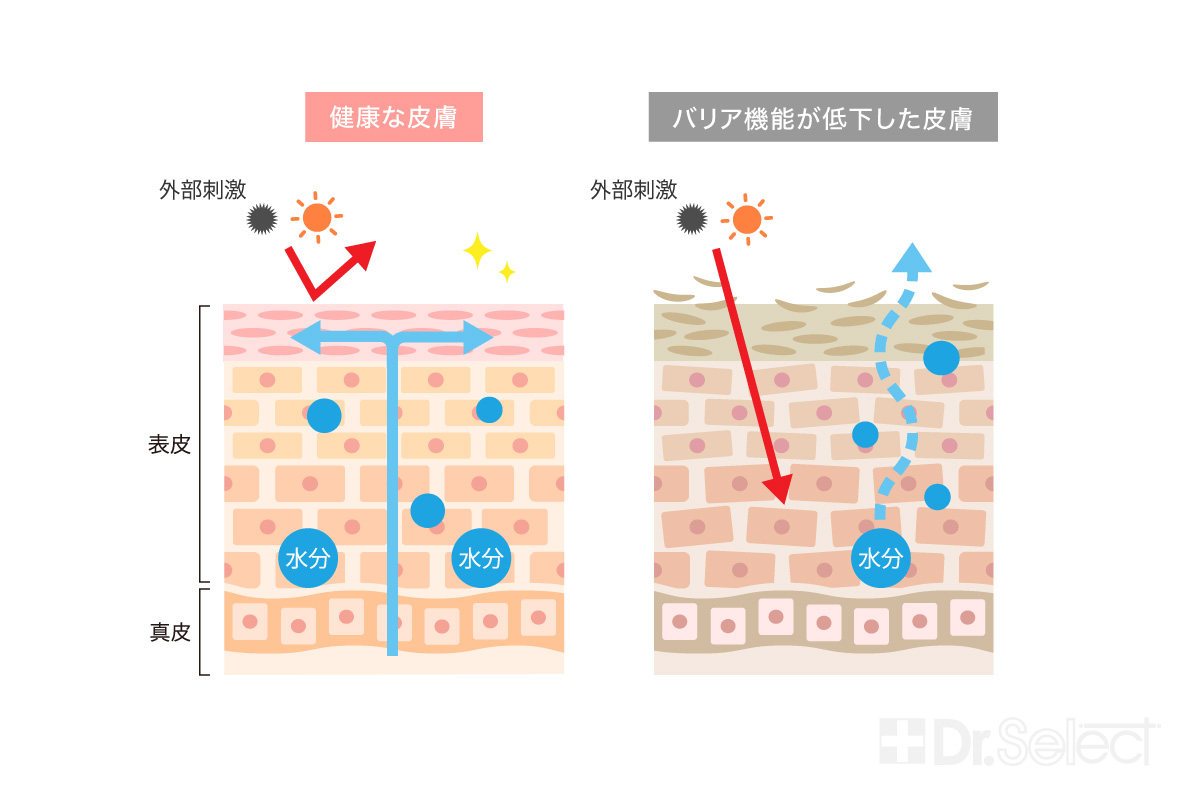 健康な肌とバリア機能が低下した肌