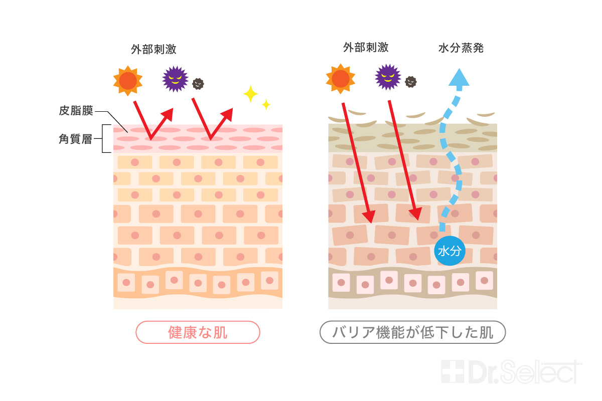 健康な肌とバリア機能が低下した肌